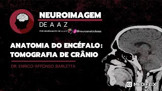 Anatomia do Encéfalo Tomografia de Crânio [upl. by Prebo]