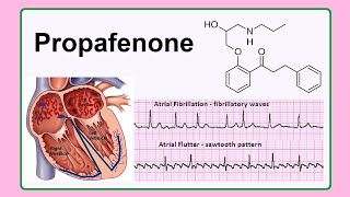 propafenone [upl. by Euqinu122]