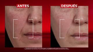 ¿Tratamientos antiedad Revitalift Laser de LOréal Paris [upl. by Phenica]