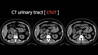 Imaging of Urinary system BRC 7 Nov 2013 Dr Mamdouh Mahfouz In Arabic 720p [upl. by Nytsrik]