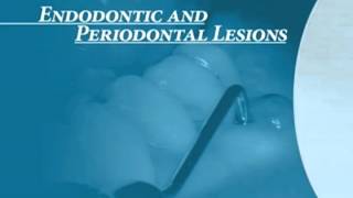 Endodontics Torabinejad 60 Endo Perio Introduction [upl. by Dlorag]