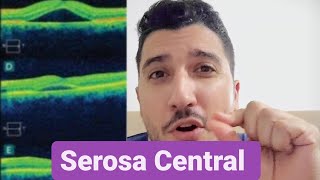 Me recuperei da Serosa Central [upl. by Martens264]