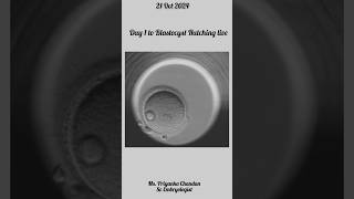 IVF Embryo Development Day by Day🧿🔬embryoculture embryologist [upl. by Isiah]