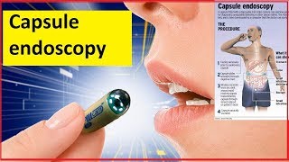 Capsule endoscopy [upl. by Layla690]