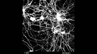 Neuron Connectivity Time Lapse [upl. by Hansel]