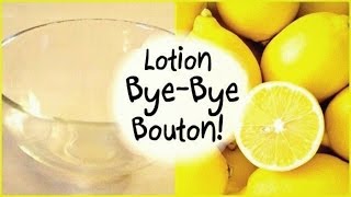 DIY Acné • Lotion Bye Bye Bouton [upl. by Enael394]