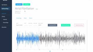 Eko Digital Stethoscope  Atrial Fibrillation [upl. by Toiboid42]