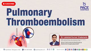 Pulmonary Thromboembolism PE  Cause Risk Factor Symptom Diagnosis Treatment amp Prevention [upl. by Nagad565]