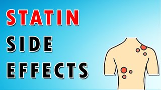 Side Effects of Statins [upl. by Queri671]