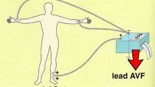 🔴 LES 12 DÉRIVATIONS ECG EXPLIQUÉES TRÈS CLAIREMENT  DR ASTUCE [upl. by Ynnoj411]