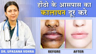 How to Remove Pigmentation Around the Mouth Upasana Ki Duniya [upl. by Yreva]