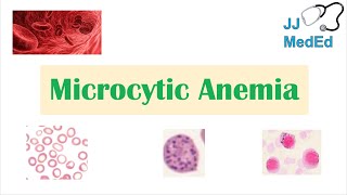 Microcytic Anemia amp Causes Iron Deficiency Thalassemia Anemia of Chronic Disease Lead Poisoning [upl. by Renckens]