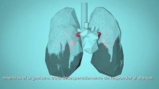 OMS Respira la Vida  Cómo la contaminación del aire afecta a tu cuerpo [upl. by Lupe672]