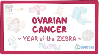 Ovarian cancer Year of the Zebra [upl. by Atsirak984]