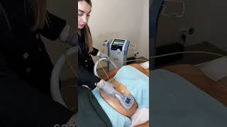 BTL Exilis Elite — Noninvasive Liposuction [upl. by Sheree]