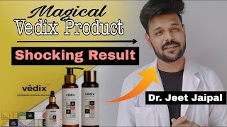 VEDIX Honest Review  VEDIX Hair Product Review 6 Month use  Vedix Result Dr Jeet Jaipal [upl. by Soraya139]