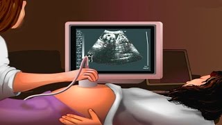 How Ultrasound Works Animation  Ultrasound Scan During Pregnancy Video  USG Medical Imaging [upl. by Eineeuq]