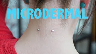 My Microdermal Piercing Experience [upl. by Ranique136]