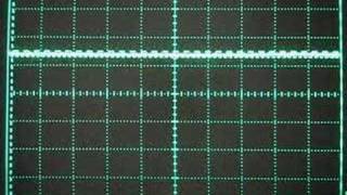 ESC scope capacitor vs no capacitor [upl. by Maryanna41]