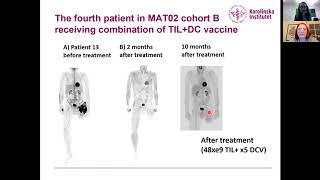 Expansion of GMP Compliant Tumor Infiltrating Lymphocytes TILs in Xuri bioreactor [upl. by Renaldo]