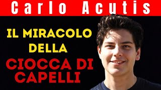 Carlo Acutis  Storia di un Miracolo Incredibile [upl. by Nadler]