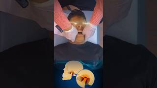 Tmj jaw adjustment 🔥 open mouth treatment trend ytshort feed feedshort [upl. by Algie]