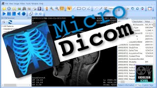 ✅MICRODICOM Convirtiendo imágenes de Google en formato DICOM [upl. by Eissen]