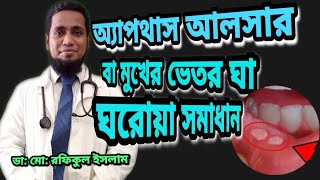 অ‌্যাপথাস আলসার এর ঘ‌রোয়া সমাধান  Aphthous ulcer in Bangla [upl. by Pellikka293]