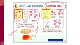 Hematology  2  U1L11  Coombs test [upl. by Downes]