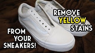 How To Remove Yellow Stains From Your Sneakers  The SIMPLEST and MOST EFFECTIVE Way [upl. by Cressy372]