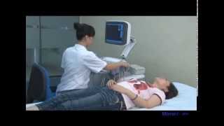 Landwind Medical Color Doppler Ultrasound Scanner Demonstration [upl. by Coleville324]