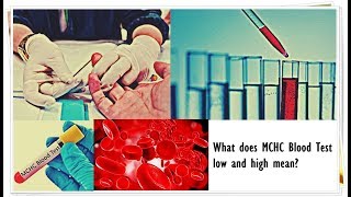 MCHC Blood Test  Low Normal High [upl. by Anert]