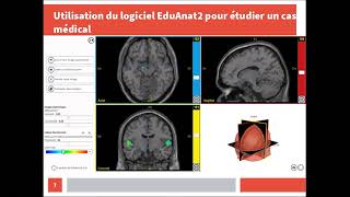 Première générale  enseignement scientifique cerveau et audition [upl. by Kilan]