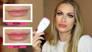 How to get BIGGER but natural looking LIPS  Story about MY lipsJUVALIPS lip plumping device review [upl. by Alolomo]