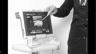 Musculoskeletal ultrasound in physiotherapy part 2 [upl. by Eidolem]