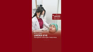 MENGATASI CEKUNGAN PADA MATA DENGAN FILLER UNDER EYE  NOVIS Dermatology [upl. by Idnat]