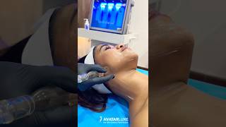 Hydrafacial in Bangalore  Koramangla [upl. by Ayimat]