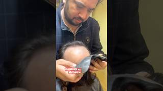 Forehead nonsurgical Hair Patch ytshorts wig video ￼ [upl. by Hessney]