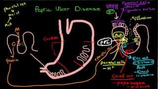 Peptic Ulcer Disease Pathophysiology [upl. by Glasgo293]