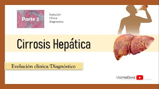 CIRROSIS HEPATICA PARTE 2 CLINICA  DIAGNOSTICO  ESCALA DE CHILD PUGH [upl. by Hedve]