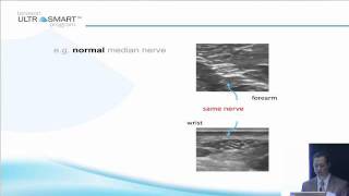 Terasons MSK Ultrasound Basics with Dr Visco Part 5 of 8 [upl. by Aicened491]