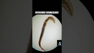 Enterobius vermicularis  Pinworm and its eggs [upl. by Samantha428]