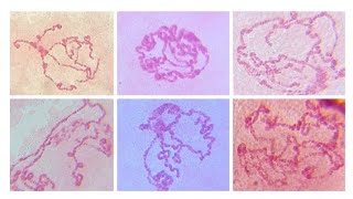 Images of polytene chromosome of Drosophila sp X150 X400 amp X1000 [upl. by Omiseno]