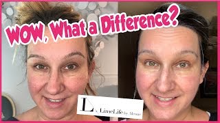 Limelife by Alcone Skincare Review [upl. by Arawaj278]