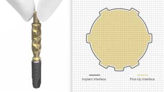 Implant PickUp Design EV  how to use  Dentsply Sirona [upl. by Alih147]