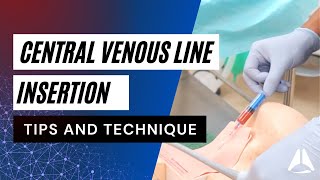 Central Venous Catheter CVC Demonstration  anesthesiology anesthesia anaesthesia cvc [upl. by Annayt674]