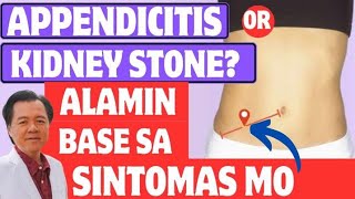 Appendicitis or Kidney Stone  By Doc Willie Ong Internist and Cardiologist [upl. by Acirred694]