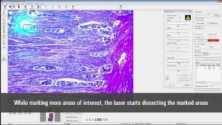 Leica Laser Microdissection Software V76 release [upl. by Cosmo171]