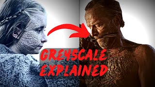 Greyscale Explained The Westerosi Disease That Leaves Flesh and Skin Dead [upl. by Mcguire748]