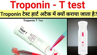 Trop t blood test  Troponin test in hindi Trop t test for heart attack blood test in Hindi [upl. by Clywd63]